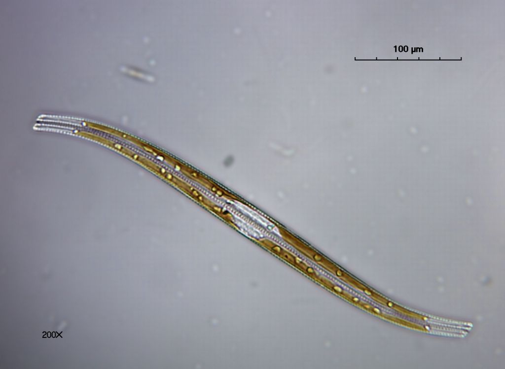 Nitzschia Sigmoidea e Nitzschia sp.